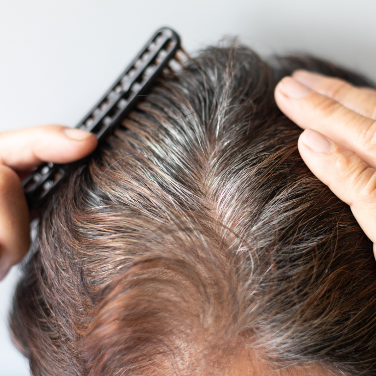 Ruka češe tmavé vlasy s výraznými šedinami a odhaluje pokožku hlavy, ilustrující stav vlasů a jejich hustotu.