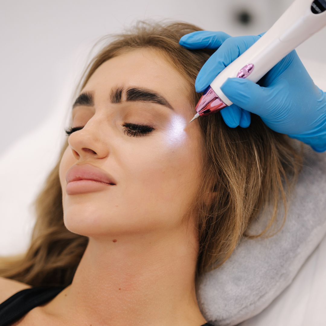 Žena podstupující ošetření plazmovým perem na čele, z přístroje drženého v rukavici vychází jasné světlo.