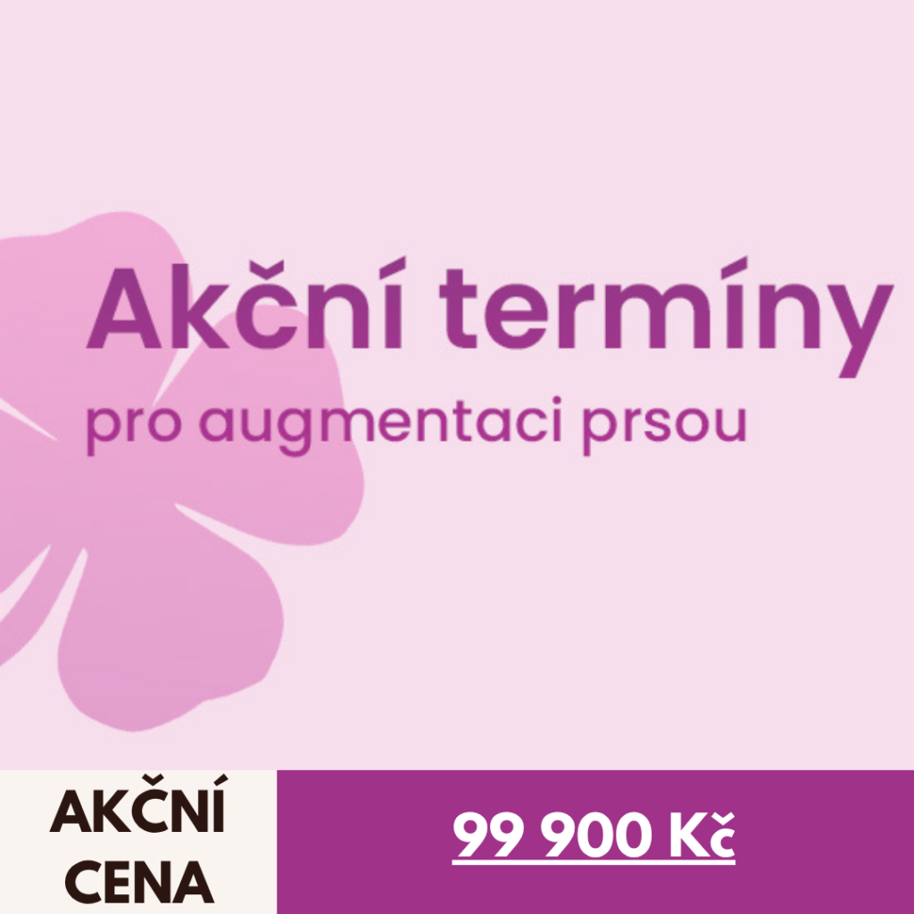 Akční termíny